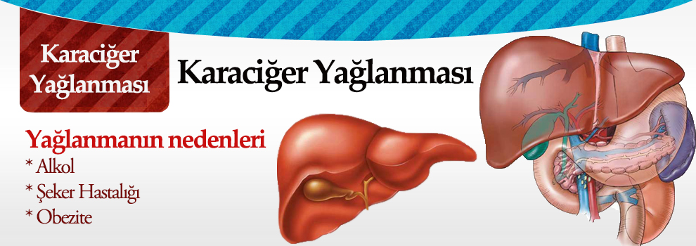 Karaciğerin yağ dejenerasyonu. Nedenleri, Belirtileri ve Tedavisi Karaciğerin yağ dejenerasyonu. Nedenleri, Belirtileri ve Tedavisi